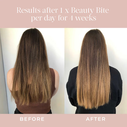 DEORTHO Protein Bars with Collagen Peptides, 3,800mg Collagen for Women, Prebiotic Fiber, Probiotics, Vitamin C & E, Low Sugar, Gluten Free, Beauty & Gut Support Snack